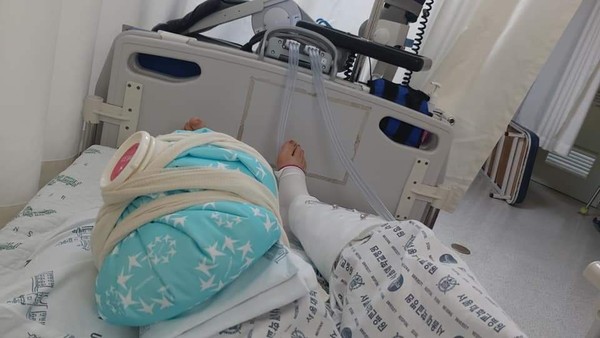 젊은 시절 교통사고 후유증으로 차일피일 미루던 무릎연골수술을 하게 된 김미화 회장